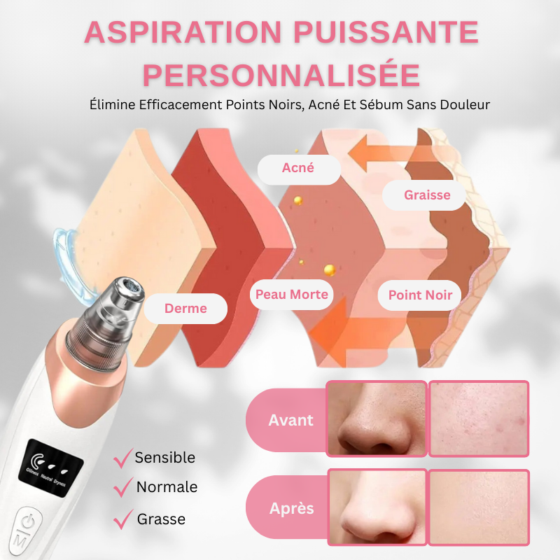 Aspirateur Point Noir Pour Visage