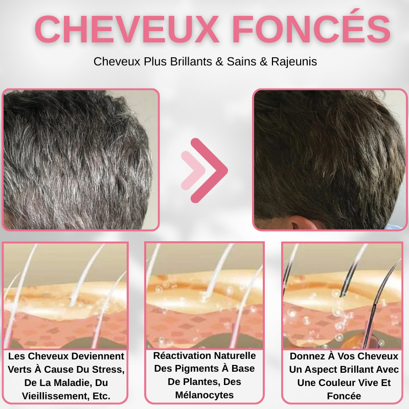 Remède Et Soin Pour Cheveux Blanc Et Gris