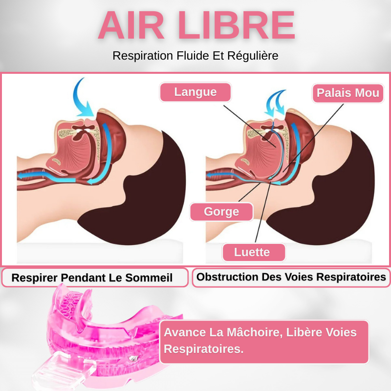 Orthèse D'avancée Mandibulaire Anti-Ronflement