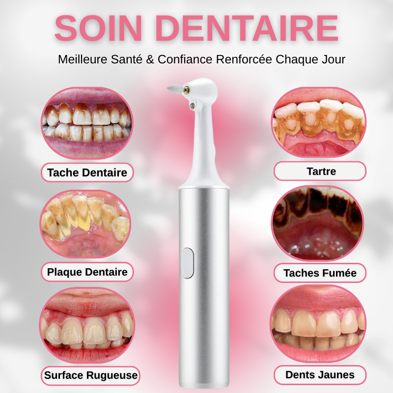 Polisseuse Dentaire Électrique Pour Blanchiment Dentaire