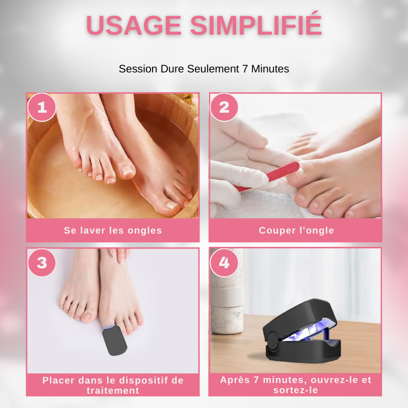 Appareil Laser LED Anti-Champignon Ongles