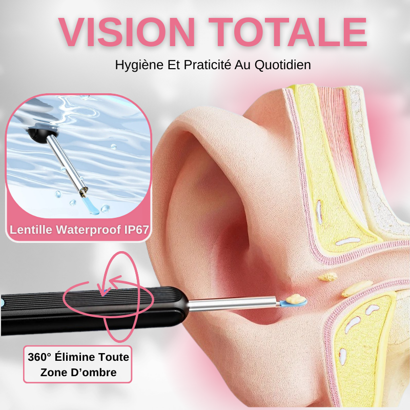 Nettoyeur Visuel Intelligent D'oreille Pour L'elimination Du Cerumen