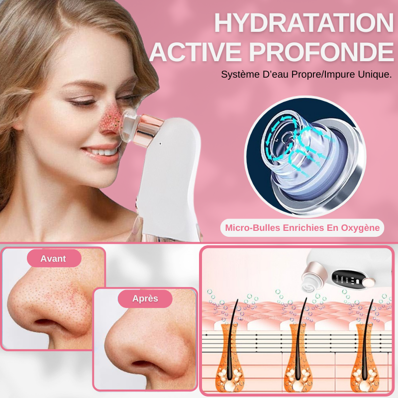 Aspirateur Électrique Extracteur De Points Noirs