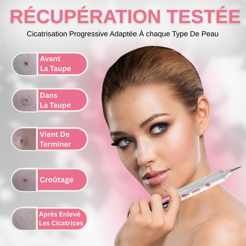 Stylo Plasma pour Enlever les Grains de Beauté