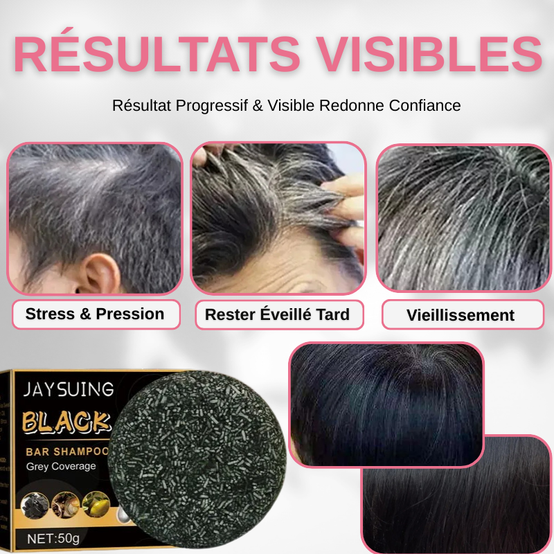 Remède Et Soin Pour Cheveux Blanc Et Gris