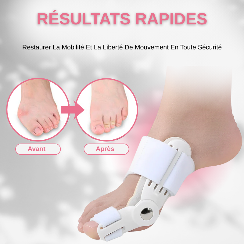Correcteur D'oignon Attelle Redresseur De Gros Orteil