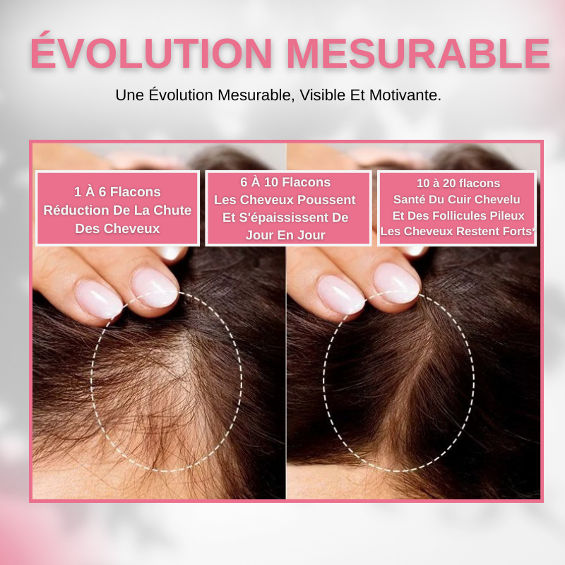 Sérum Anti-perte de cheveux