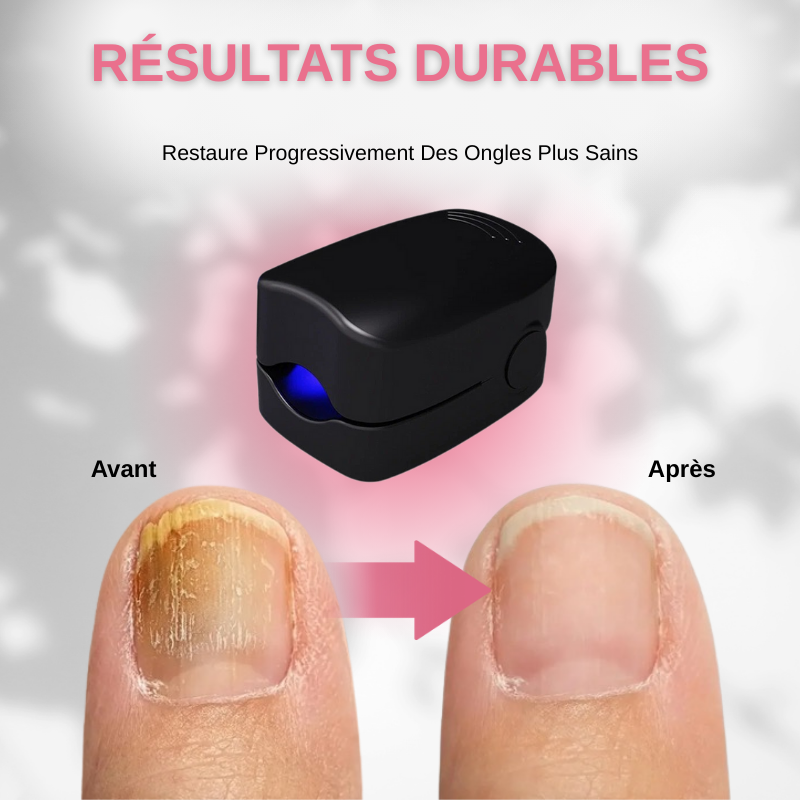 Appareil Laser LED Anti-Champignon Ongles